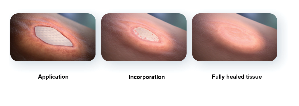 STR_tissue_stages.png
