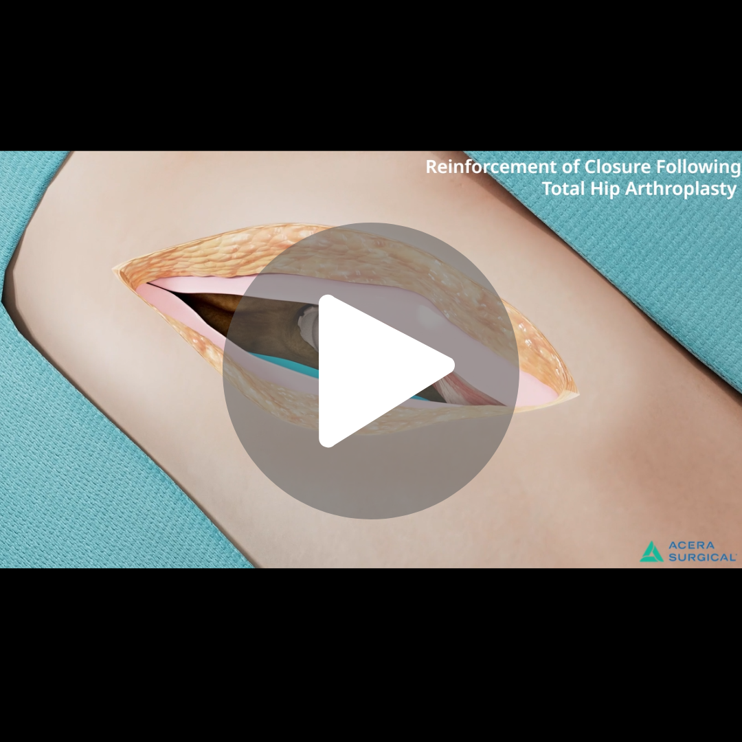 arthroplasty_web.png